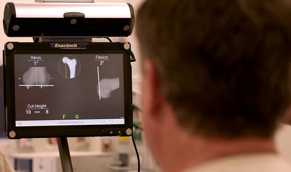 Truliant-Knee-System-Surgeon-ExactechGPS