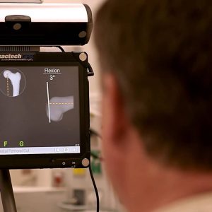 Truliant-Knee-System-Surgeon-ExactechGPS